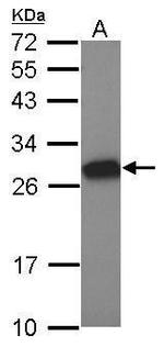 Tesmin Polyclonal Antibody