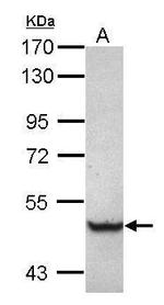 TRIM68 Antibody in Western Blot (WB)