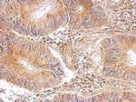 RPL8 Antibody in Immunohistochemistry (Paraffin) (IHC (P))