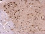 RPL8 Antibody in Immunohistochemistry (Paraffin) (IHC (P))
