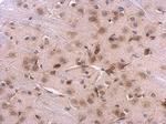 RPL8 Antibody in Immunohistochemistry (Paraffin) (IHC (P))