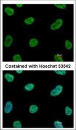 SENP3 Antibody in Immunocytochemistry (ICC/IF)