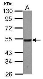 UHMK1 Antibody in Western Blot (WB)