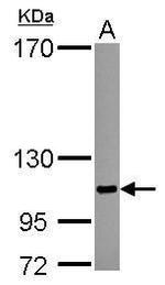 SENP5 Polyclonal Antibody