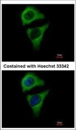 ASB8 Polyclonal Antibody