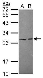 HECTD2 Polyclonal Antibody