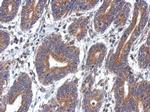 DEPDC7 Antibody in Immunohistochemistry (Paraffin) (IHC (P))