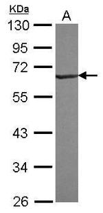 RNF25 Polyclonal Antibody