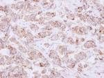 USP46 Polyclonal Antibody