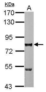 ZNF179 Polyclonal Antibody