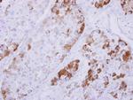 NDRG4 Polyclonal Antibody