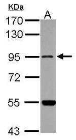 MARS2 Polyclonal Antibody