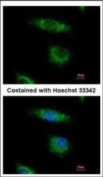 ORP5 Polyclonal Antibody