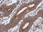 HS3ST2 Polyclonal Antibody