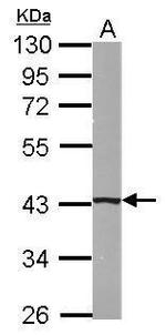 B4GALT5 Polyclonal Antibody