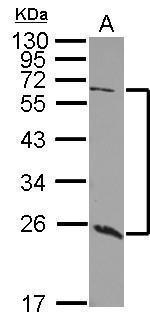 GALNT9 Polyclonal Antibody
