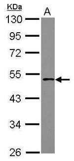 PCYT1B Antibody in Western Blot (WB)