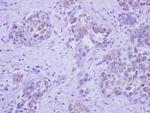 GALNT2 Polyclonal Antibody