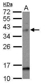 MAD2L1BP Polyclonal Antibody