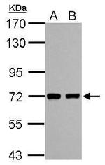 HCC1 Polyclonal Antibody