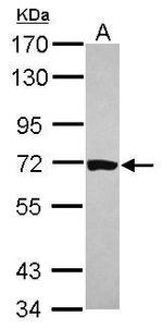 HCC1 Antibody in Western Blot (WB)