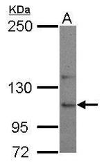 USP26 Antibody in Western Blot (WB)