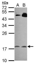 RGS8 Polyclonal Antibody
