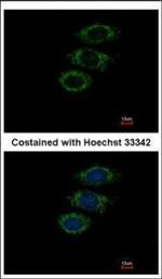 PPIL1 Polyclonal Antibody