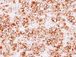 Calpain S1 Antibody in Immunohistochemistry (Paraffin) (IHC (P))