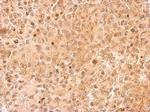 UFD1L Antibody in Immunohistochemistry (Paraffin) (IHC (P))