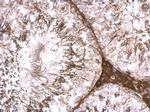ENC-2 Antibody in Immunohistochemistry (Paraffin) (IHC (P))