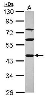 PDE7A Polyclonal Antibody