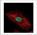 EXOSC8 Polyclonal Antibody