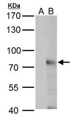 RNF168 Polyclonal Antibody