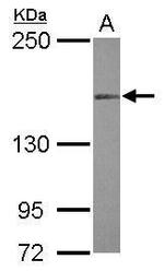 MLH3 Polyclonal Antibody