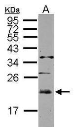 UBE2E3 Polyclonal Antibody