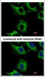 CHMP2B Polyclonal Antibody