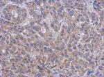 SPTLC2 Polyclonal Antibody