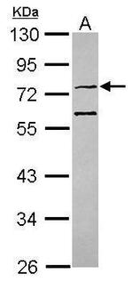 CMG1 Polyclonal Antibody