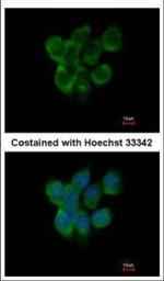 APOBEC3F Polyclonal Antibody