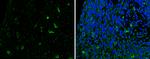 SLIT2 Polyclonal Antibody