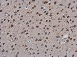 SLIT2 Antibody in Immunohistochemistry (Paraffin) (IHC (P))