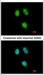 PPIH Polyclonal Antibody