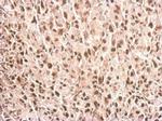 PPIH Antibody in Immunohistochemistry (Paraffin) (IHC (P))
