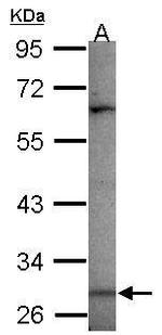 MAGEA3 Polyclonal Antibody