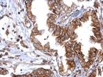 RAD51 Antibody in Immunohistochemistry (Paraffin) (IHC (P))