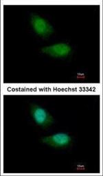 FBXO28 Polyclonal Antibody