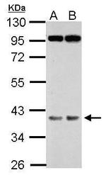 FBXO28 Antibody in Western Blot (WB)