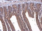 RAB39B Antibody in Immunohistochemistry (Paraffin) (IHC (P))