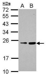 RAB39B Antibody in Western Blot (WB)